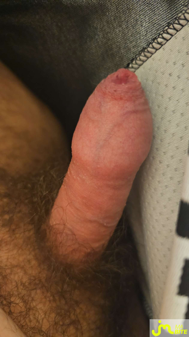 bites de Crty