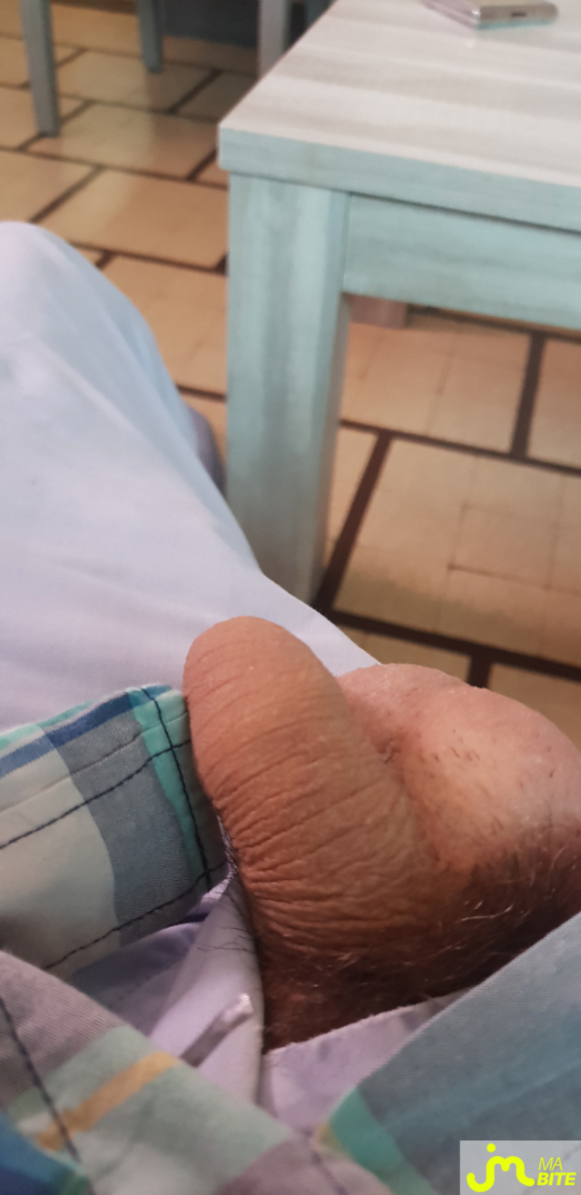 bites de Amor