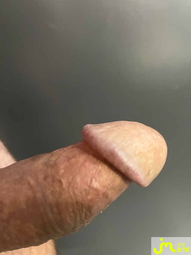 bites de Raou