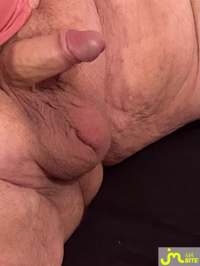 bites de Vix44