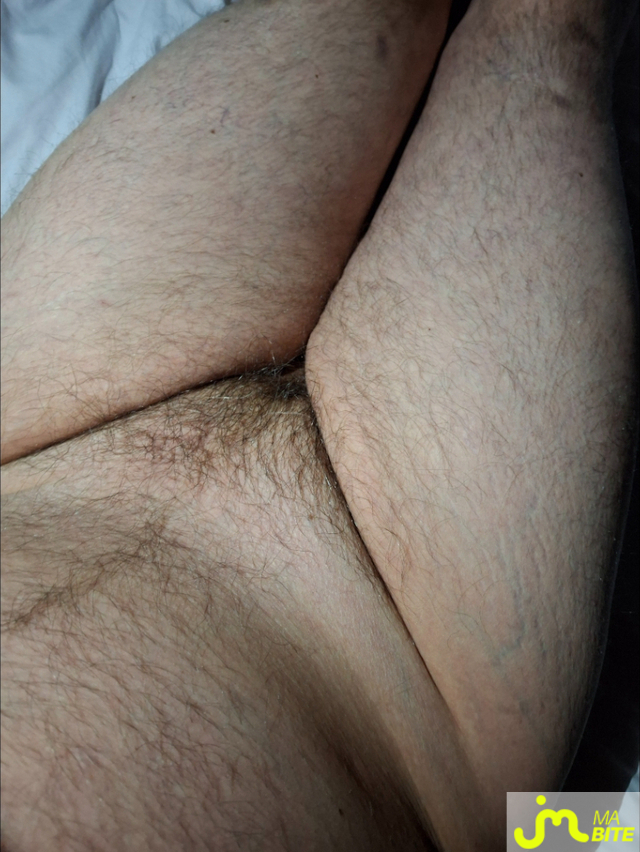 bites de Man80