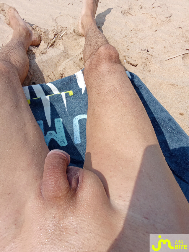 bites de A. Laize