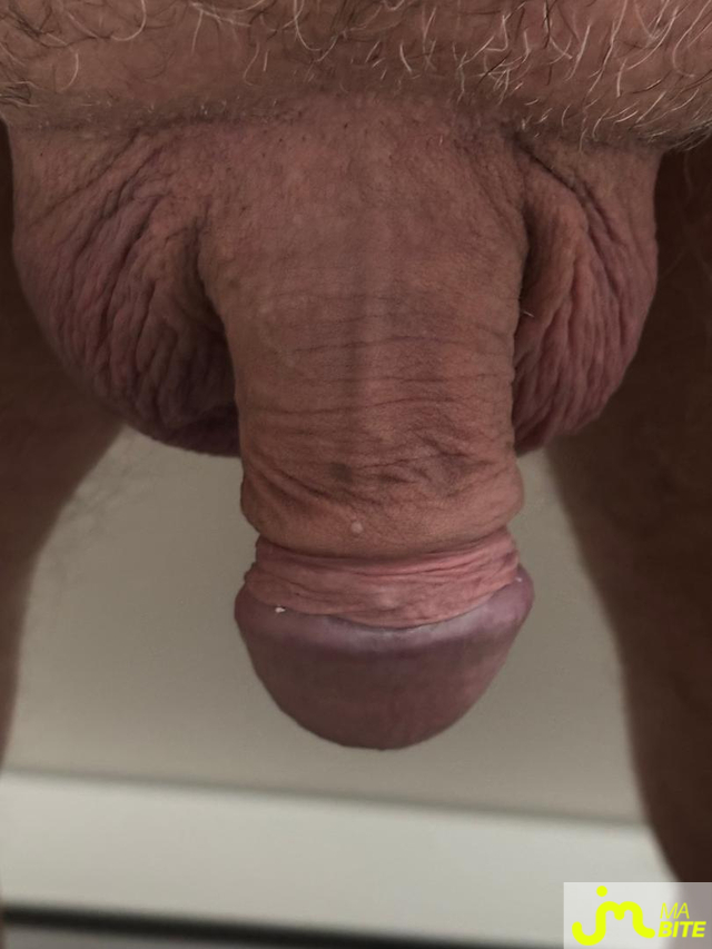 bites de Boomer