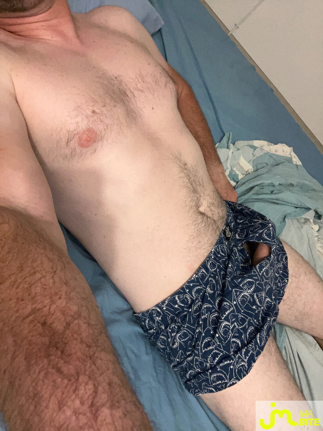 bites de jumpers91