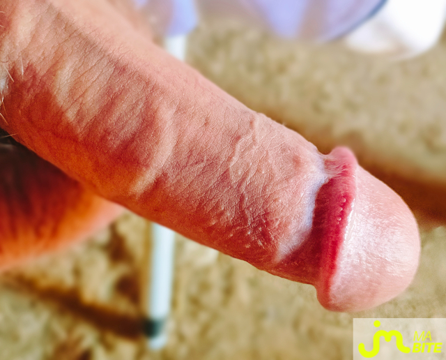 bites de MiddleLeg