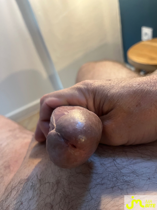 bites de Raou