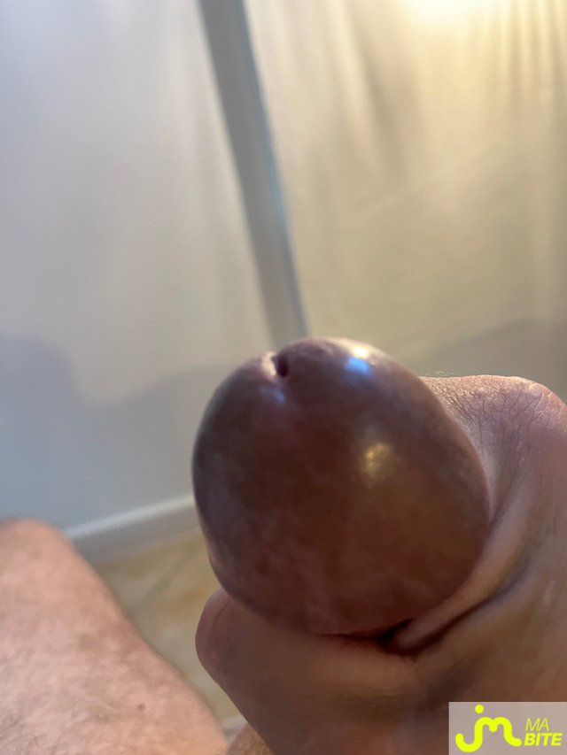 bites de Raou