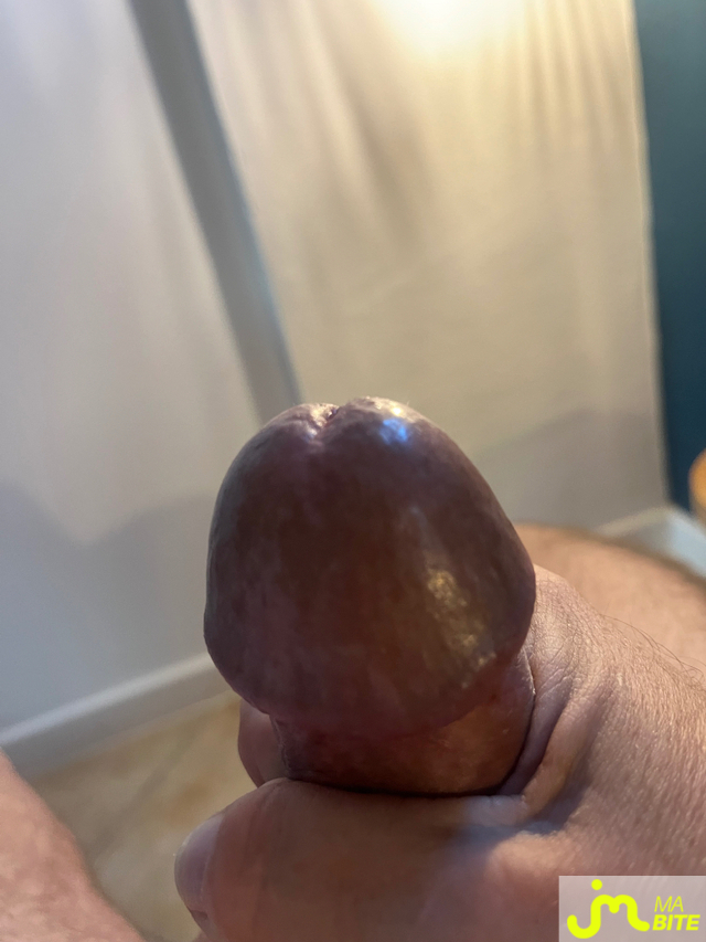 bites de Raou
