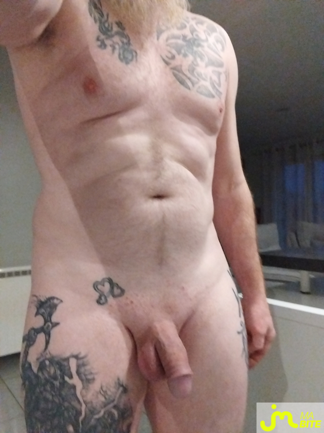 bites de mrtox