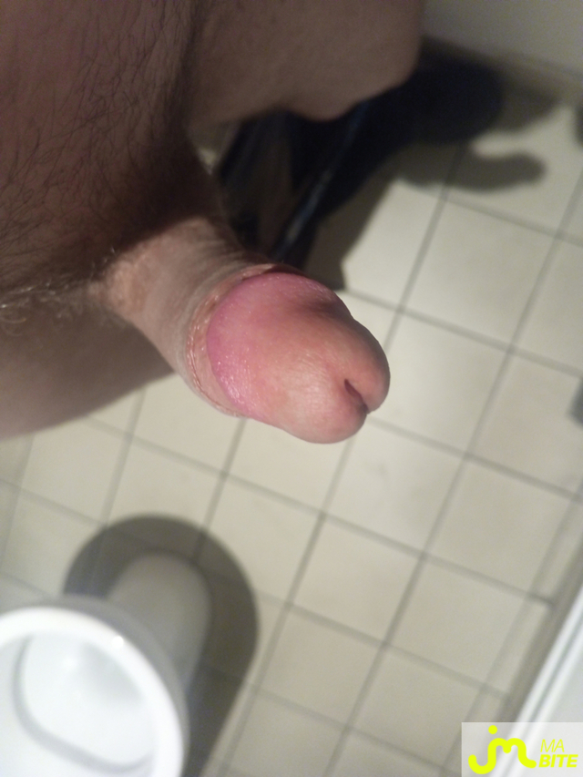 bites de Pok02
