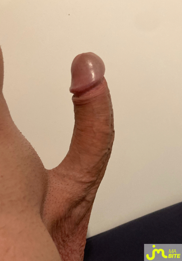 bites de Ricko89