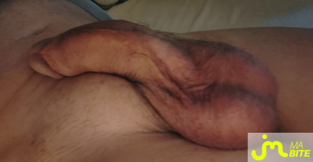 bites de van3005