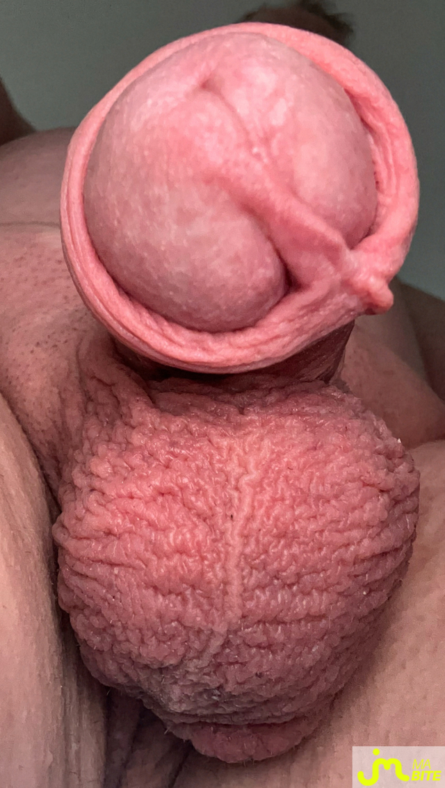 bites de Dhoudh41