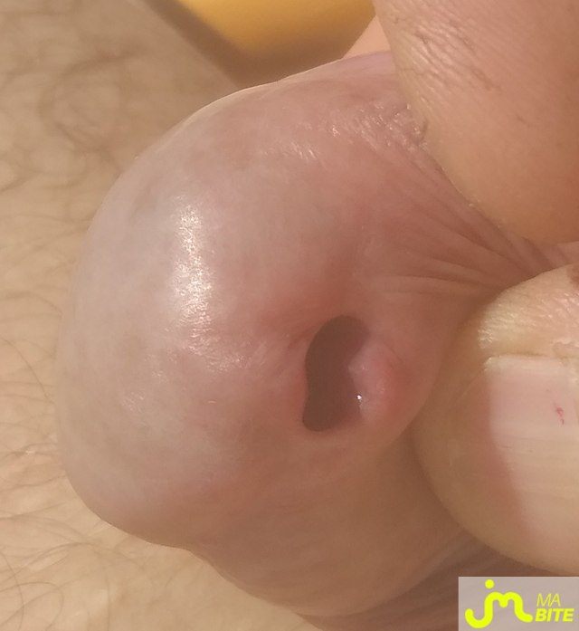 bites de Lami63