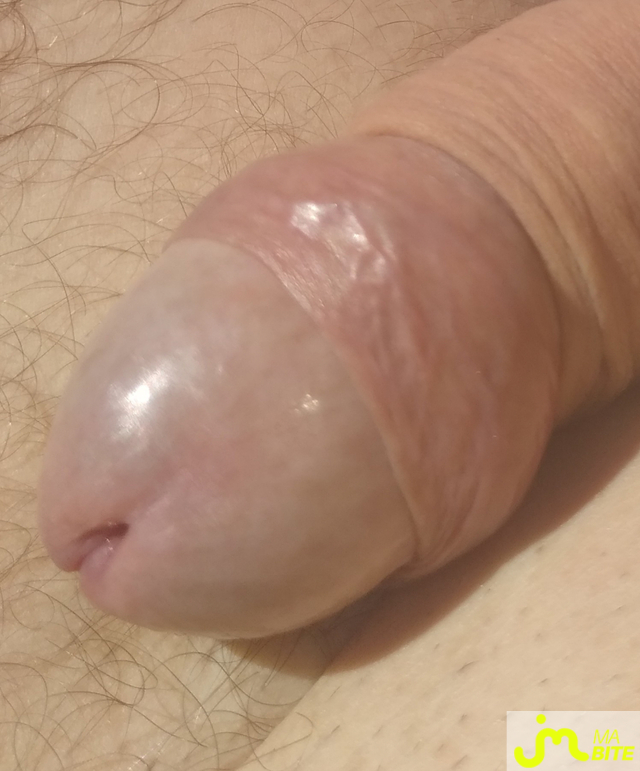 bites de Lami63