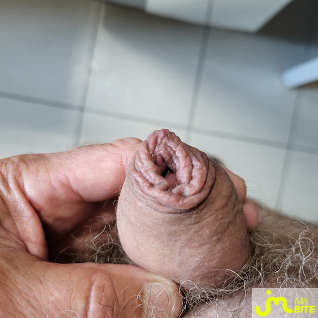 bites de Gland perlé