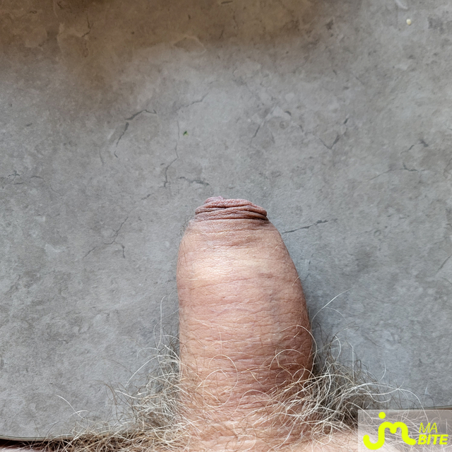 bites de Gland perlé