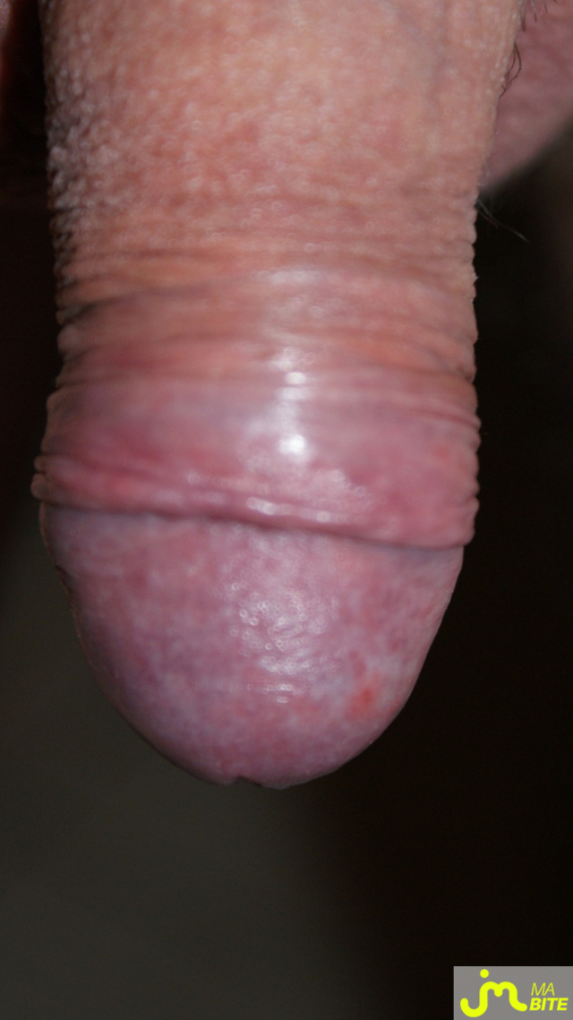 bites de ange76