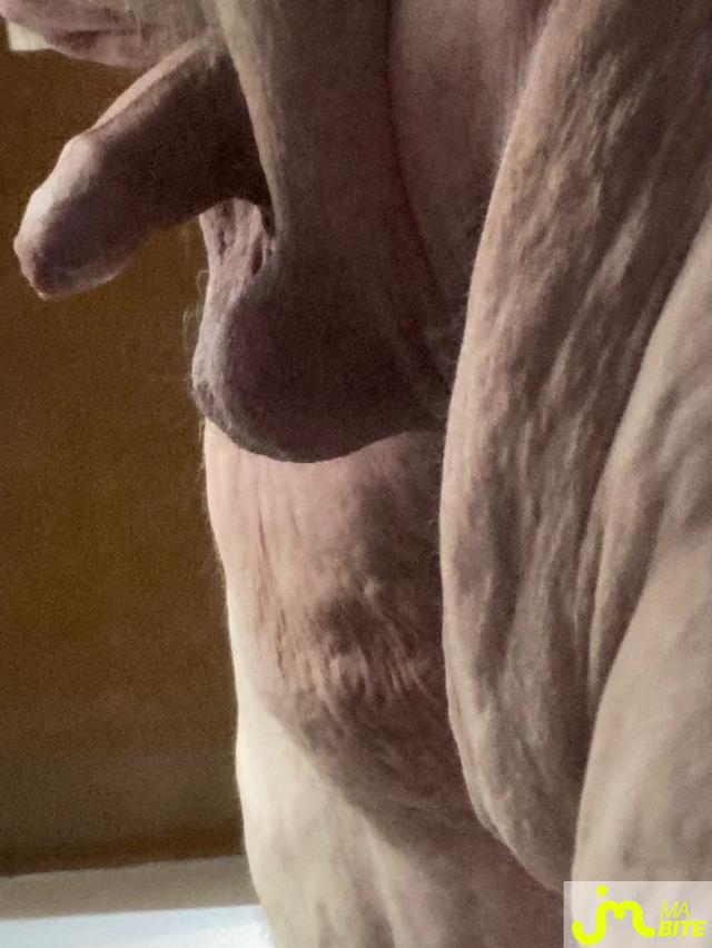 bites de Vix44