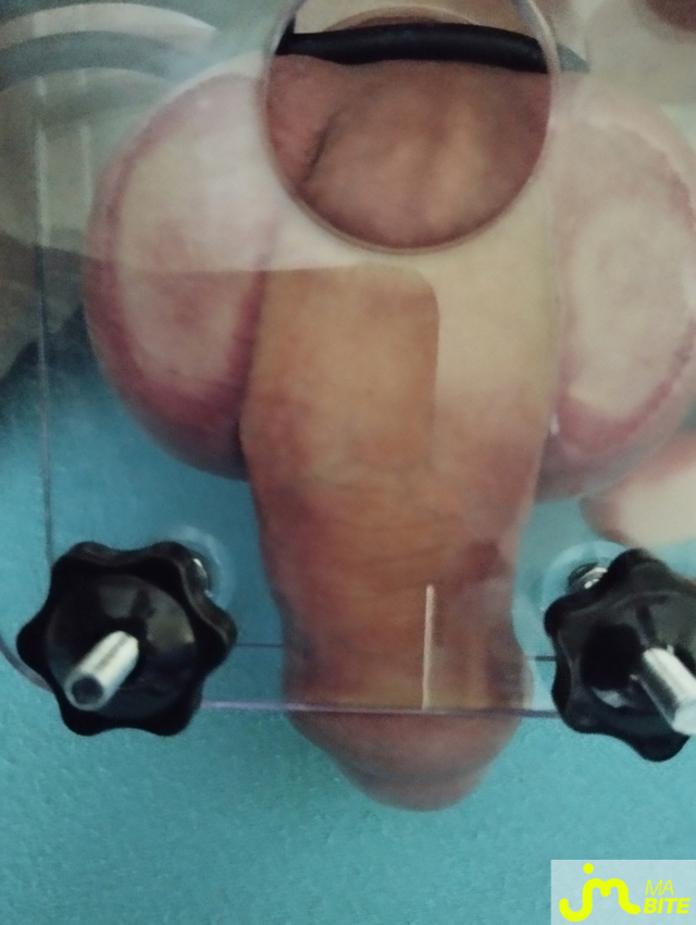 bites de Cycliste18cm
