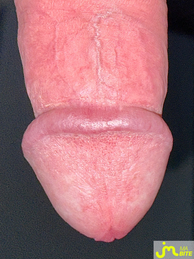 bites de Couplebibaiseurs
