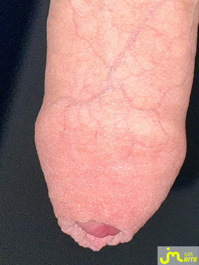 bites de Couplebibaiseurs