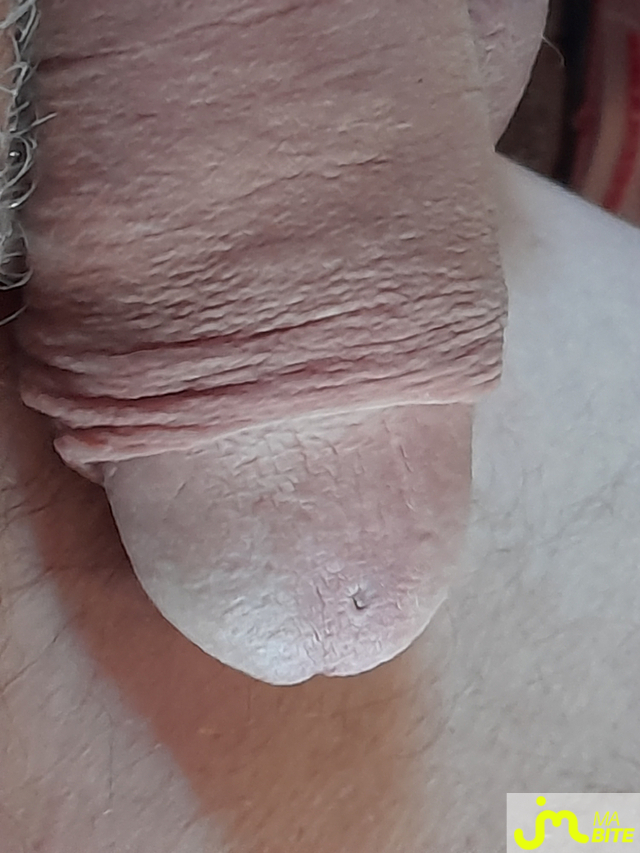 bites de Eliot 69