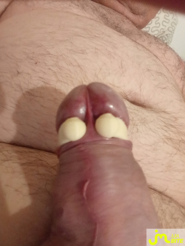 bites de MIKE83600