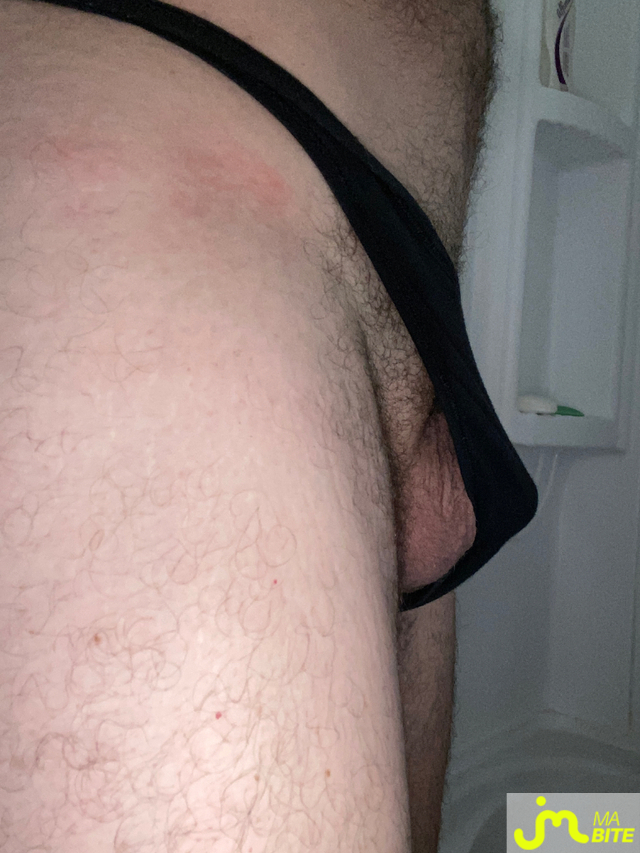 bites de Doigts