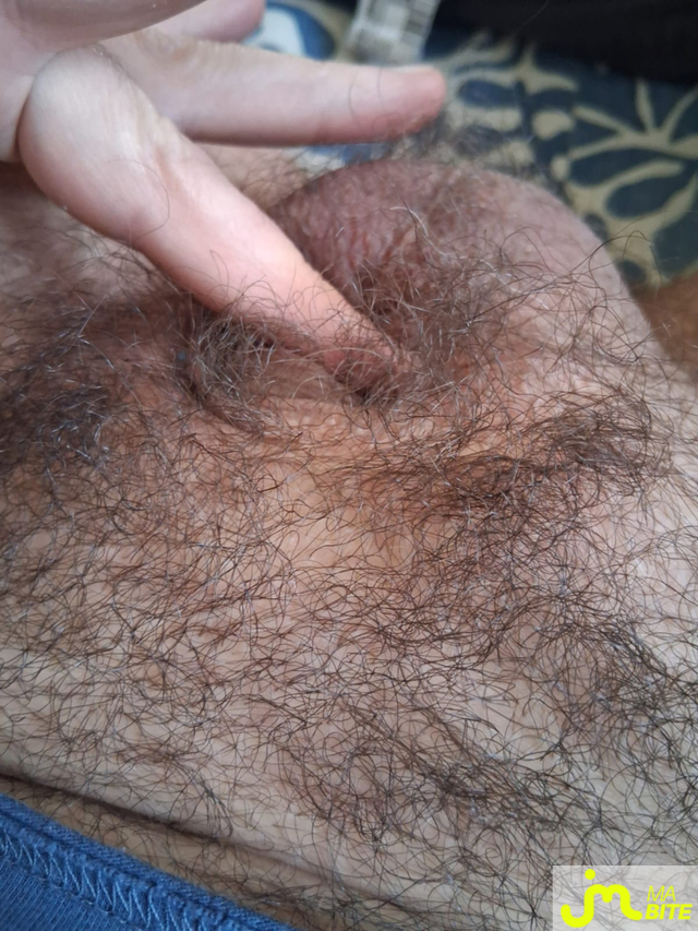 bites de oktogon