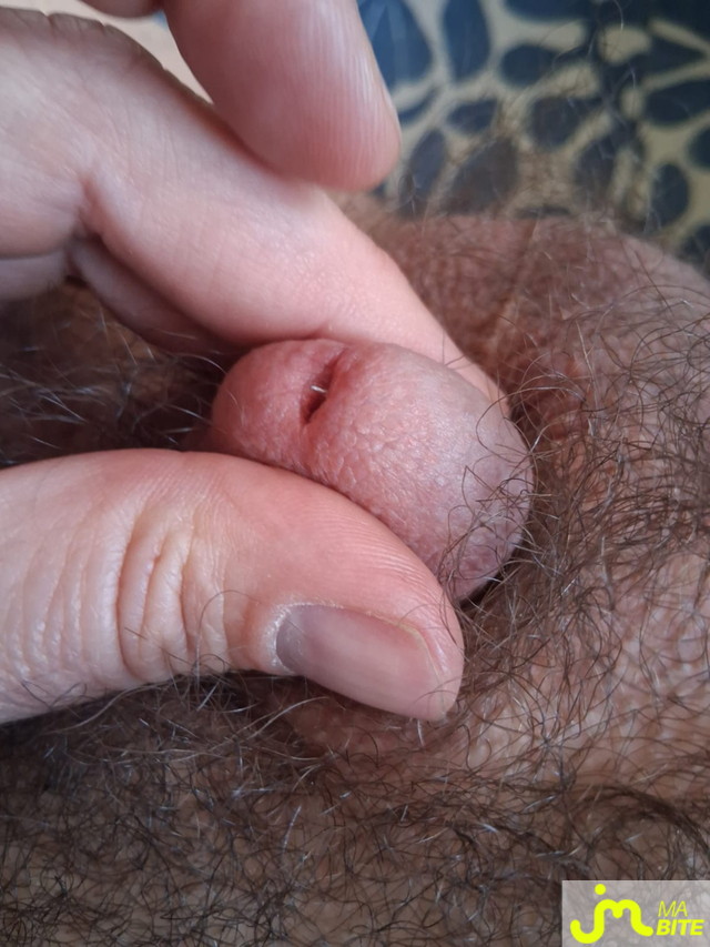 bites de oktogon