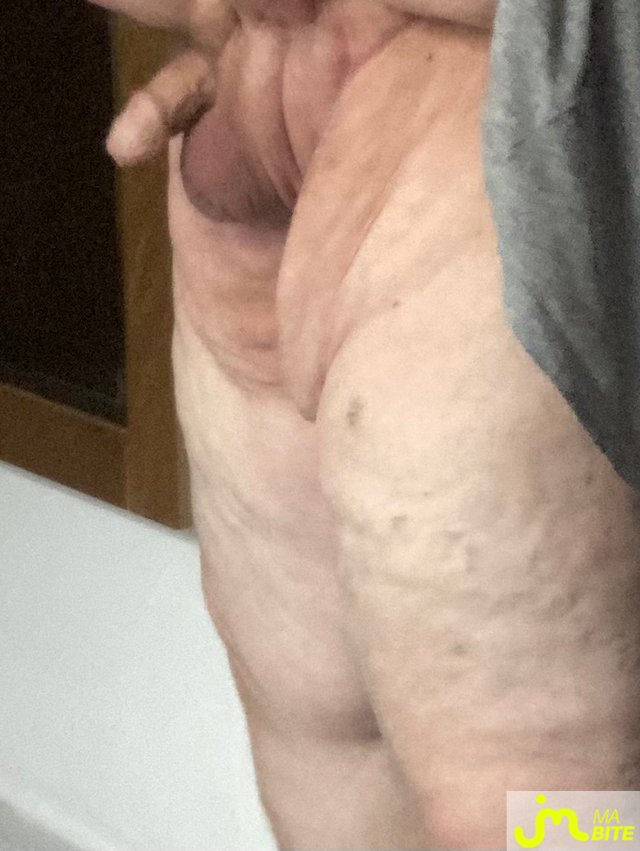 bites de Vix44