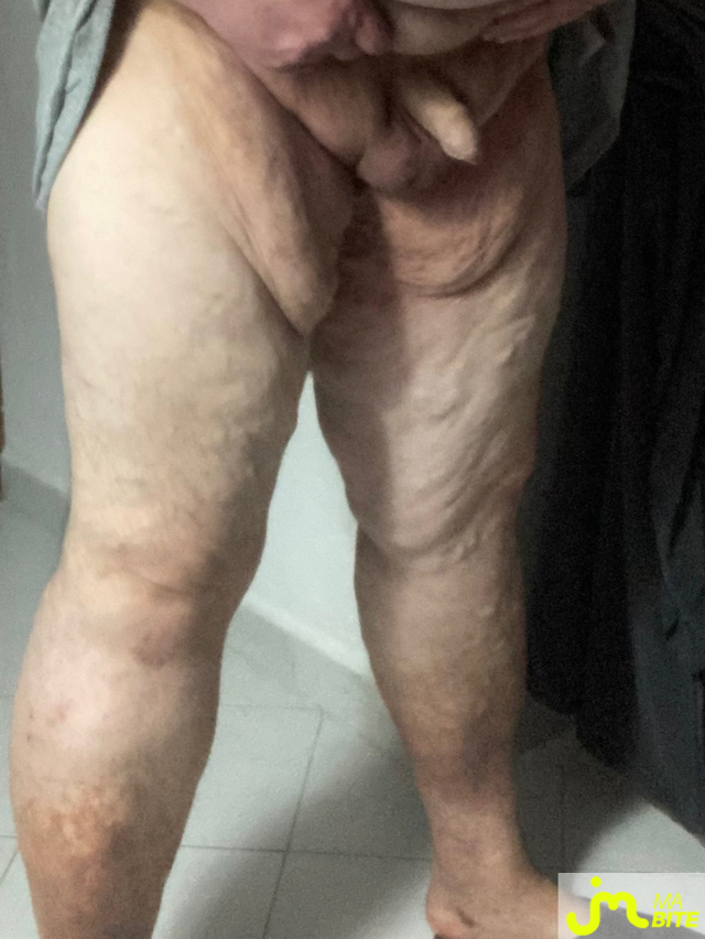 bites de Vix44