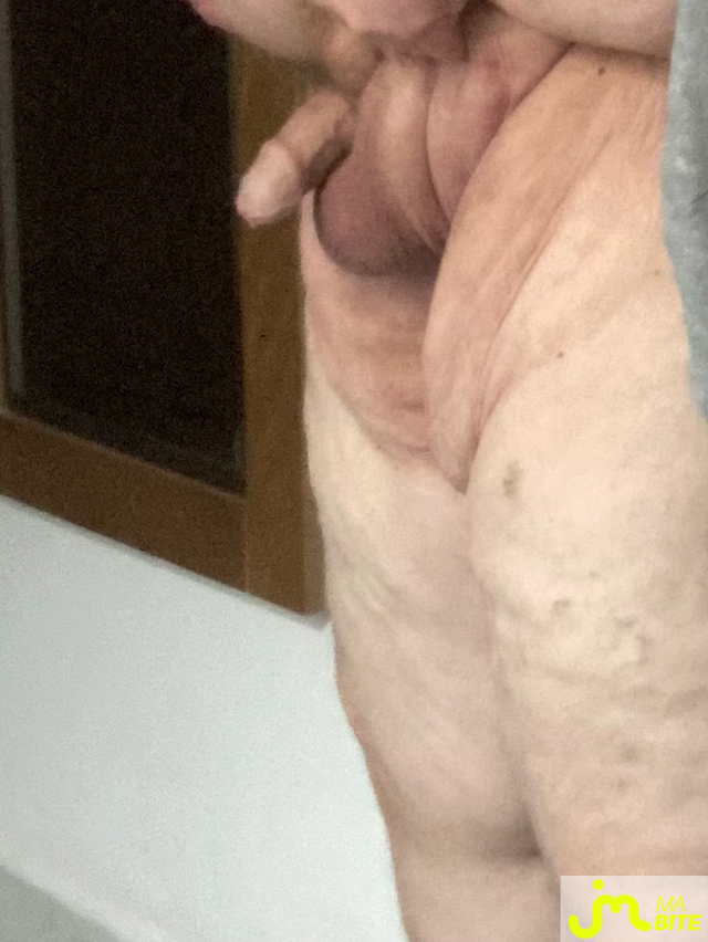 bites de Vix44