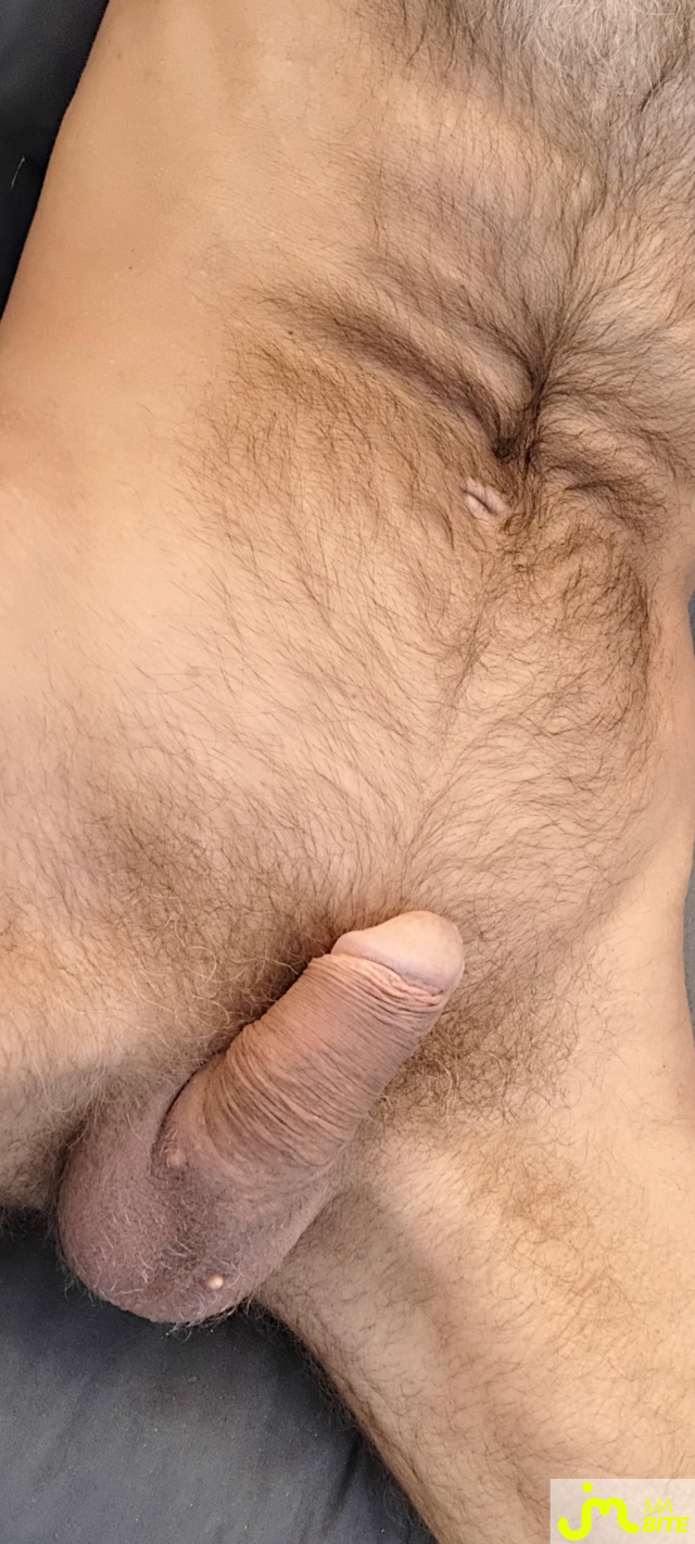 bites de kawabite