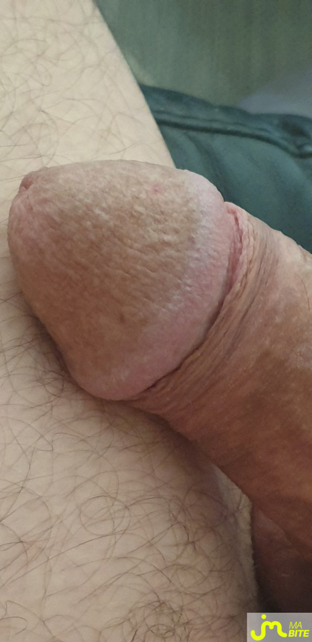 bites de Jeumedonne