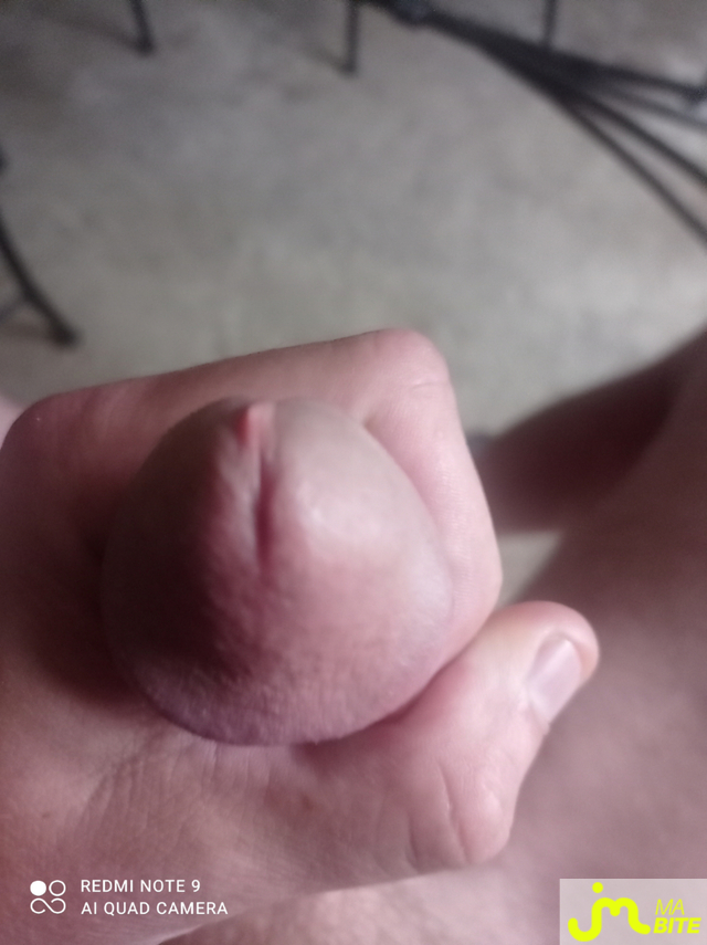 bites de kisdec