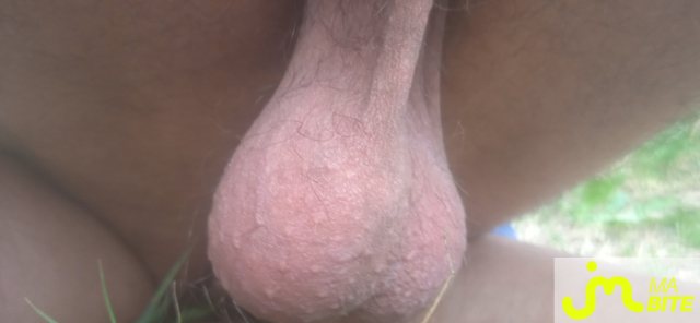 bites de Étirement boules