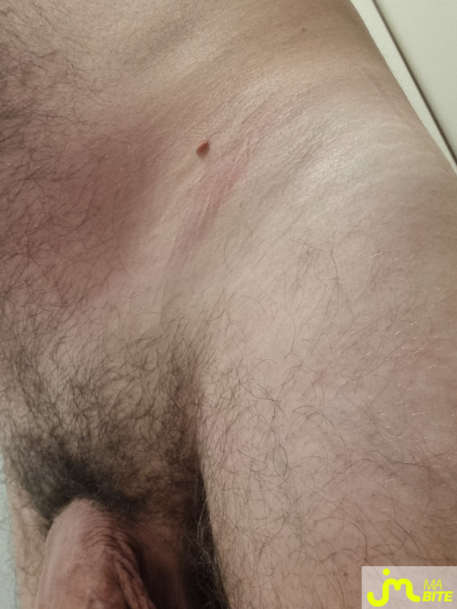 bites de Kiki13