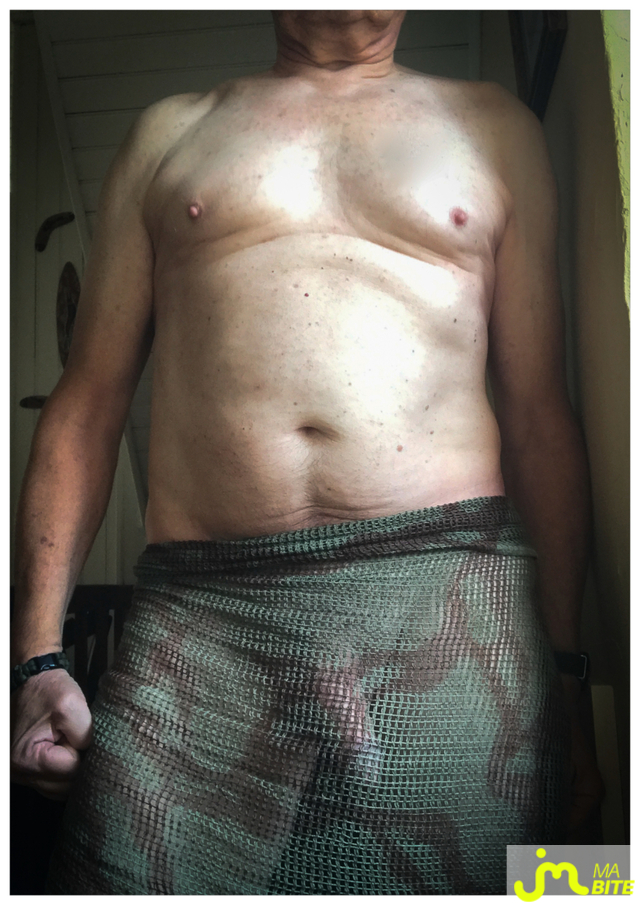 bites de LUI 61200