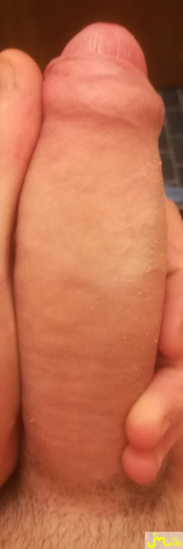 bites de Rifta