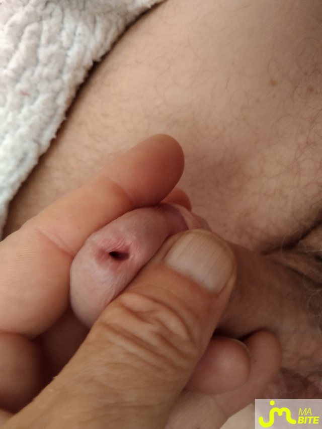 bites de Le brestoas