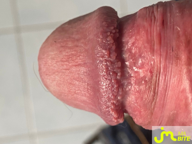 bites de cuniman77