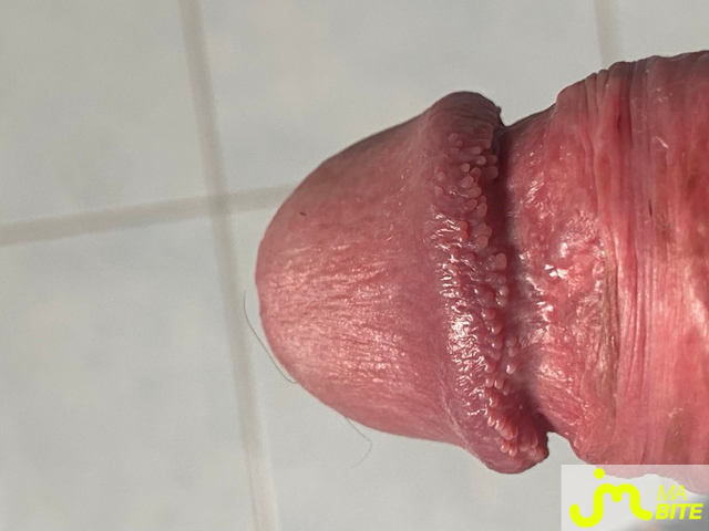 bites de cuniman77