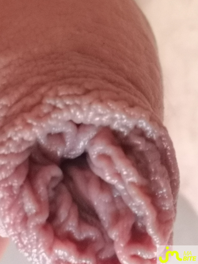 bites de Juste25