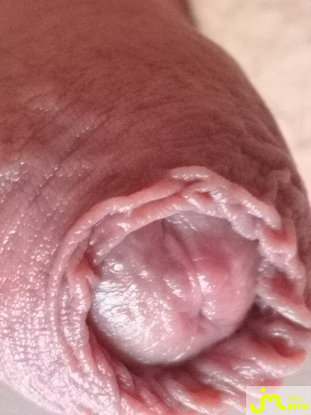 bites de Juste25