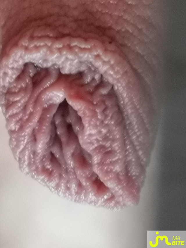bites de Juste25