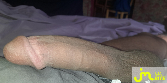 bites de Éricoupe75