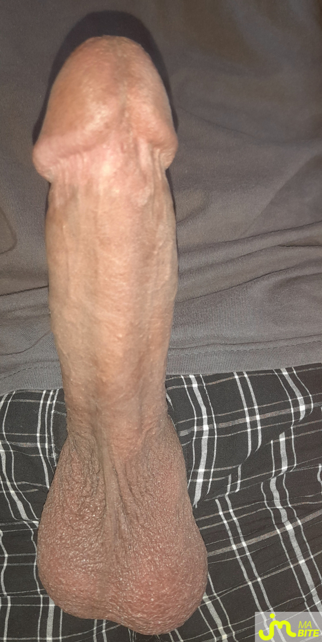 bites de Éricoupe75