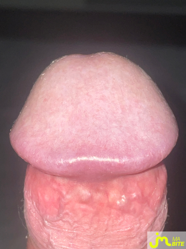 bites de L690969